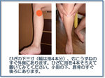 疲れを取る　足三里（あしさんり）のツボ