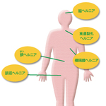 ヘルニア　Hernia