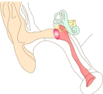 中耳炎　Tympanitis